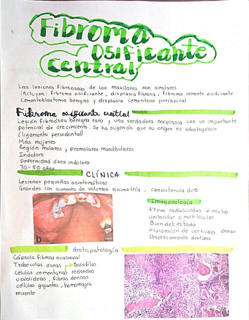 Fibroma osificante central