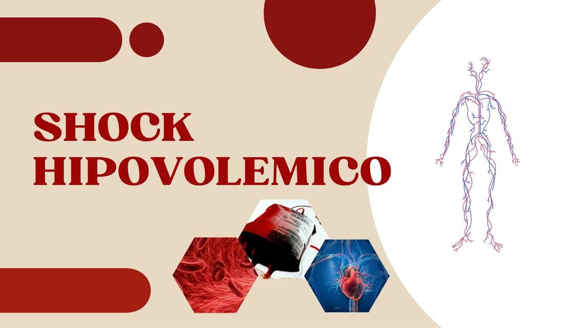 Flashcards de Shock hipovolemico | Por Prisila Velasco | uDocz