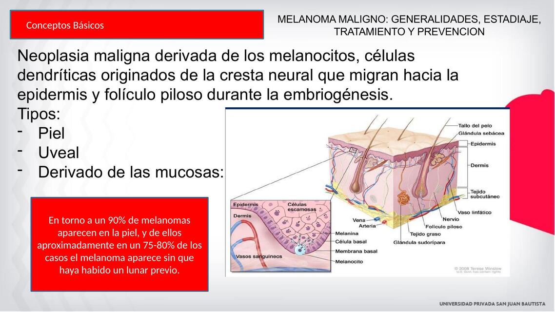 Melanoma maligno 