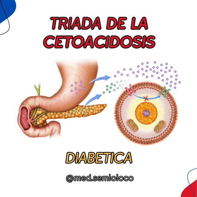 Triada de la cetoacidosis | Víctor Rodriguez Botero - @med.semioloco ...