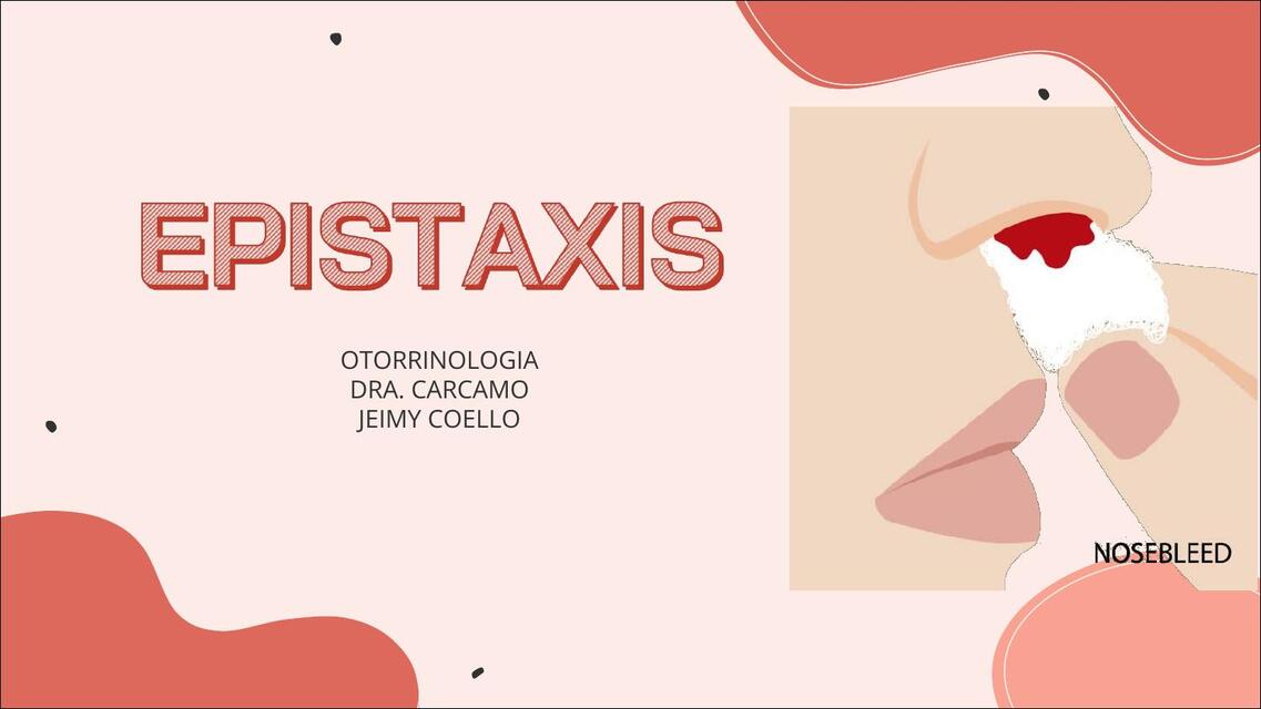 Epistaxis