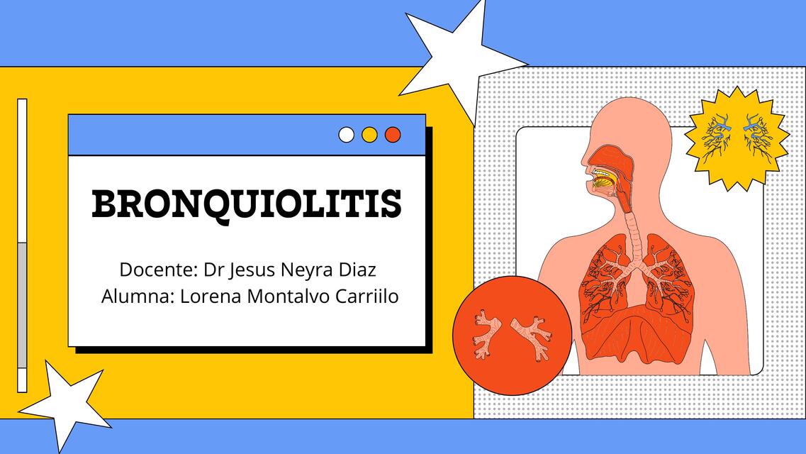 Bronquiolitis 