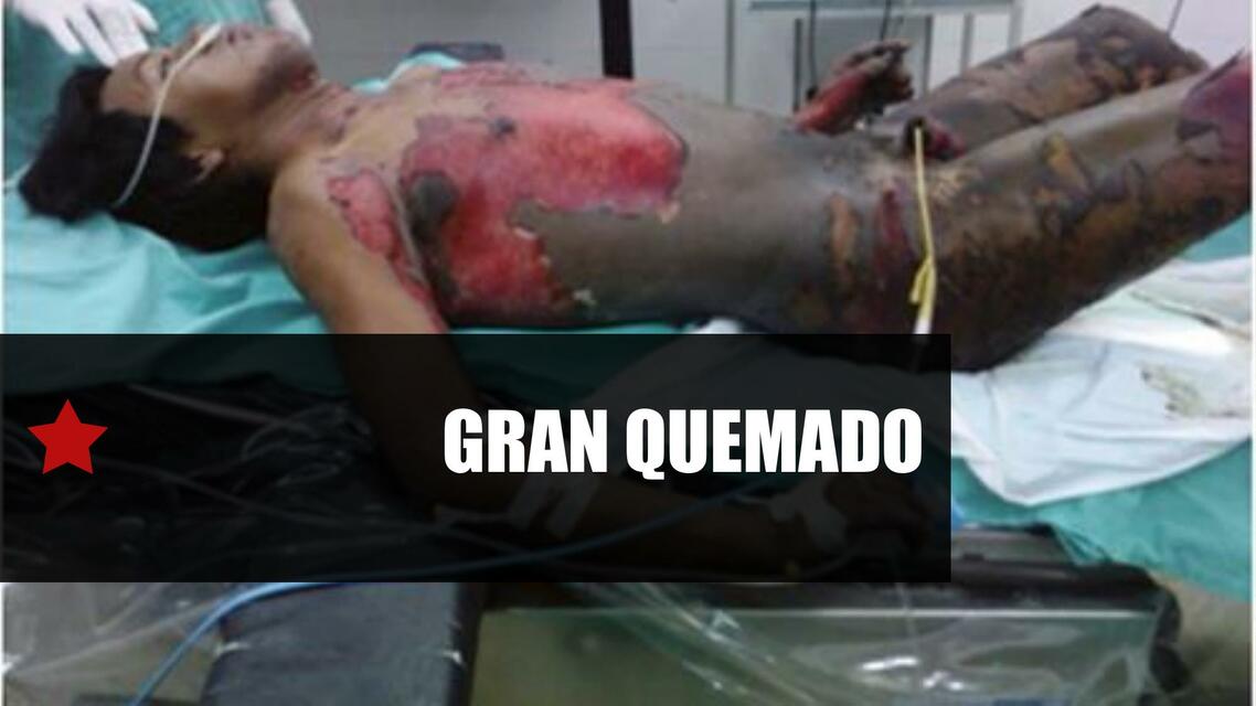 Gran Quemado