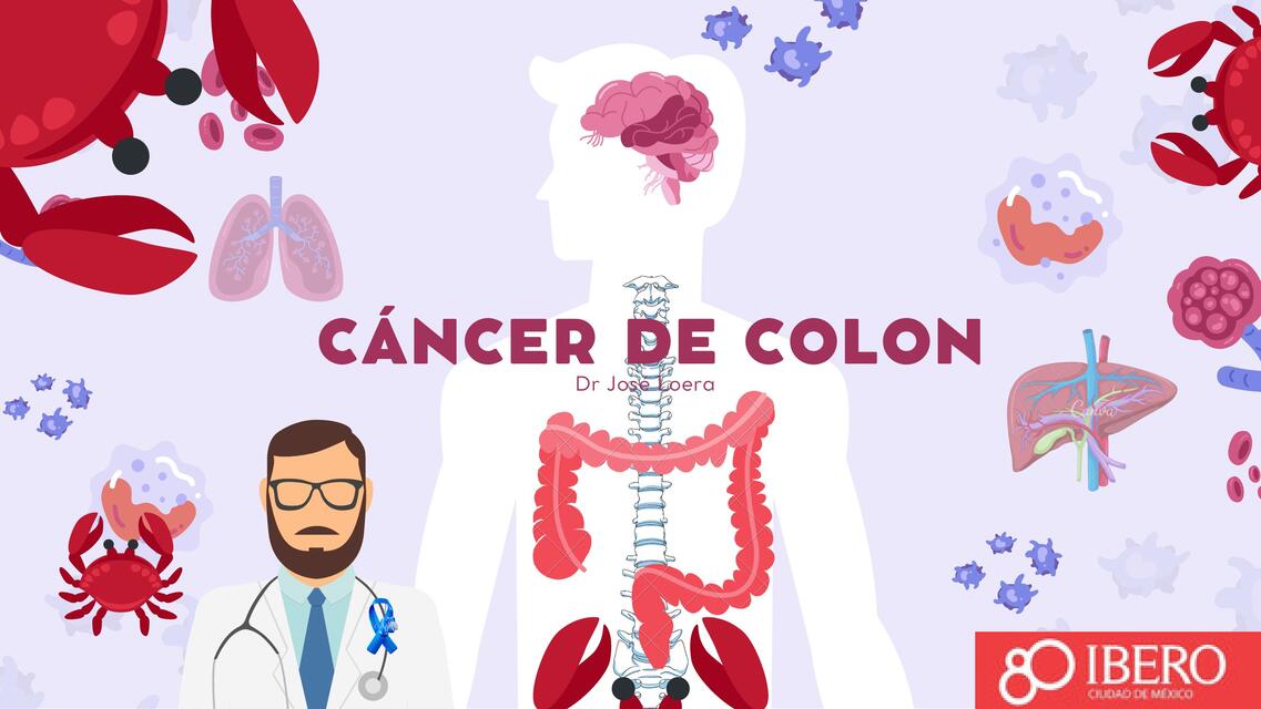 Cáncer de colon 