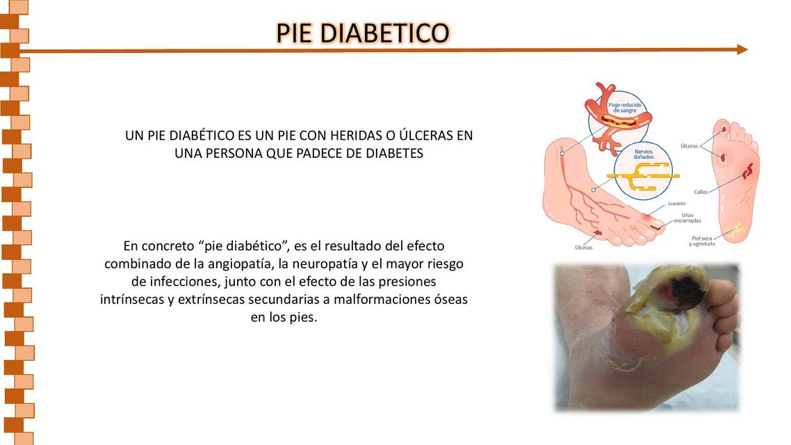 Pie diabetico Maryoserghio Quintanilla uDocz