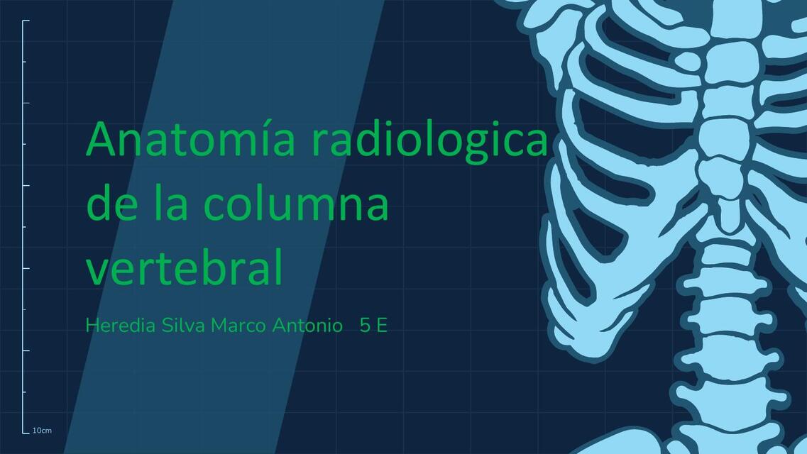 Anatomía radiológica de la columna vertebral 