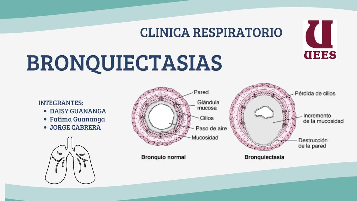 Bronquiectasias  