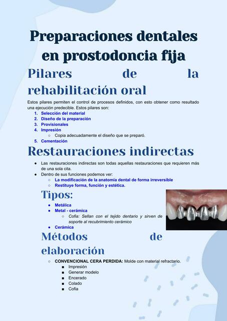 Preparaciones dentales en prostodoncia fija