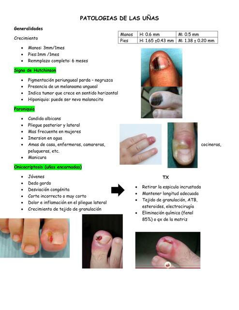 Patologías de las uñas