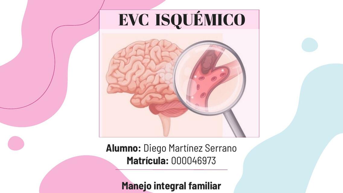 EVC Isquémico 