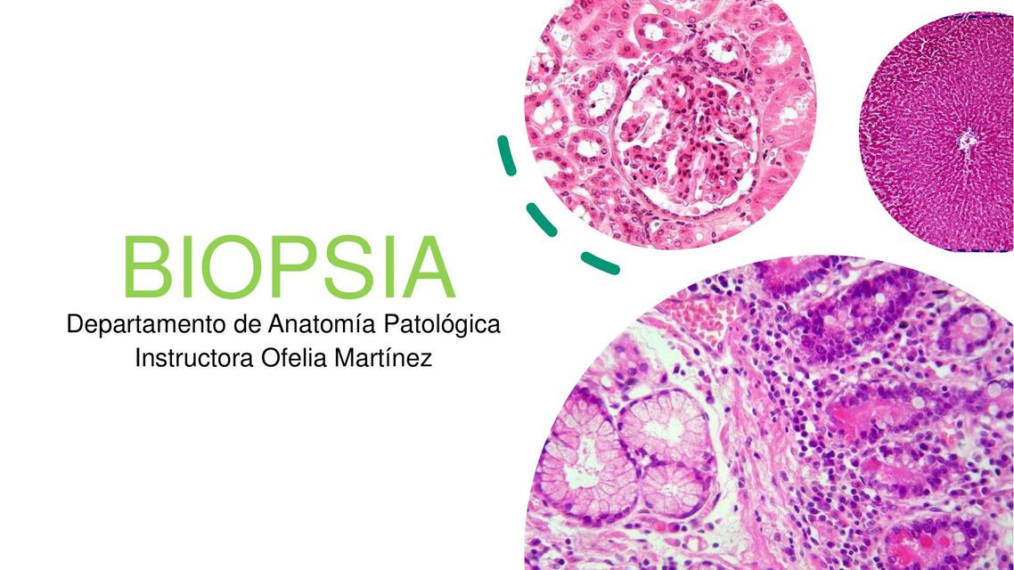 Biopsia 