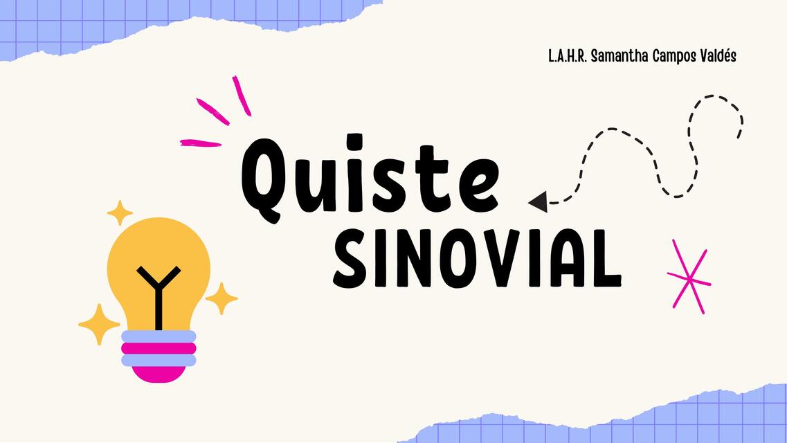 Quiste sinovial 