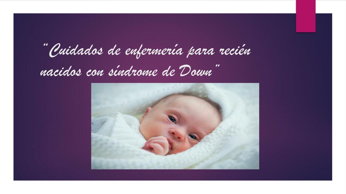 Sindrome de down 