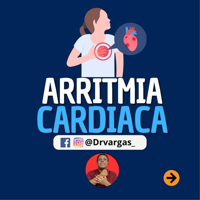 Arritmias cardiacas 