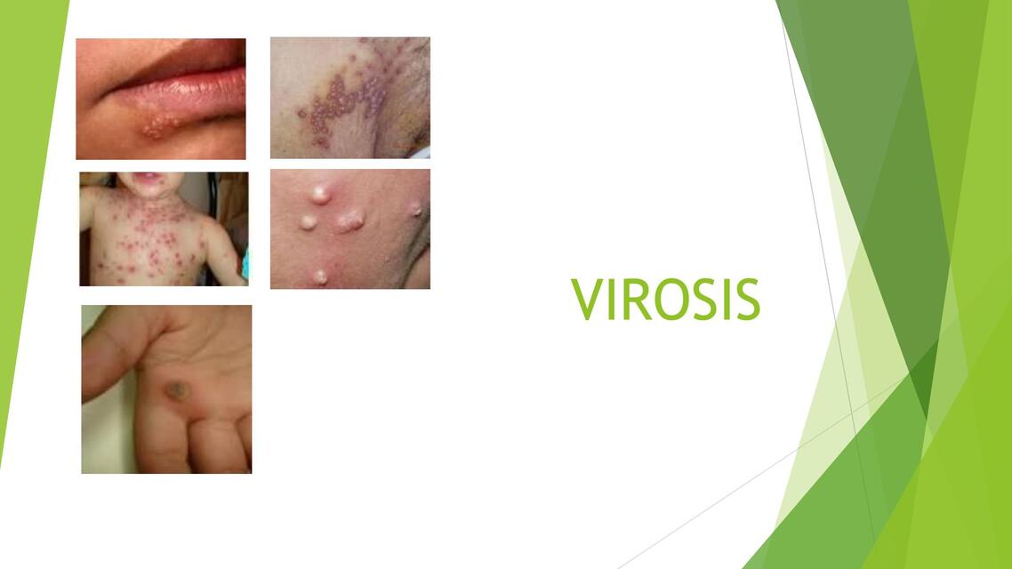 Virosis 