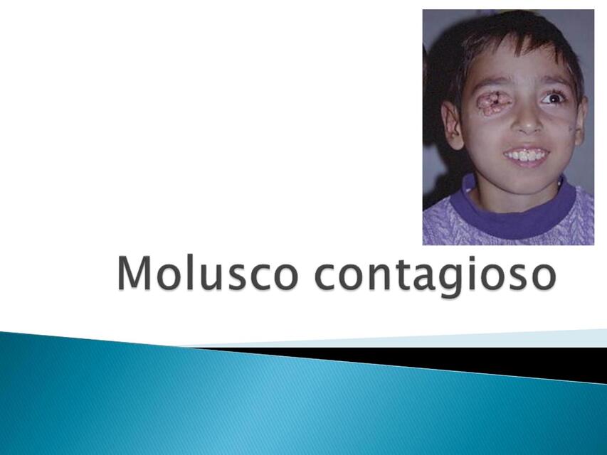 Molusco contagioso 