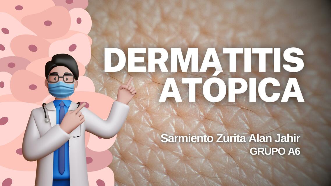 DERMATITIS Átopica ESPECIALIDADES UMSS