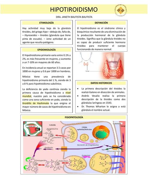 Hipotiroidismo 