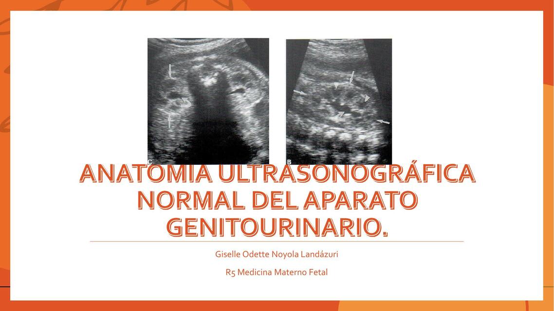 Anatomía ultrasonográfica normal del aparato genitourinario