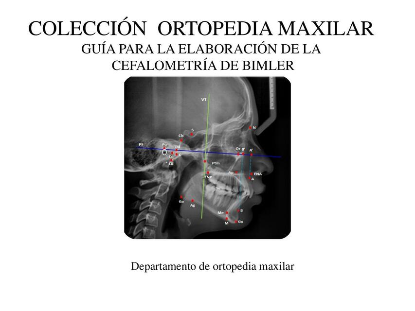 Guía para la elaboración de la cefalometría de Bimler