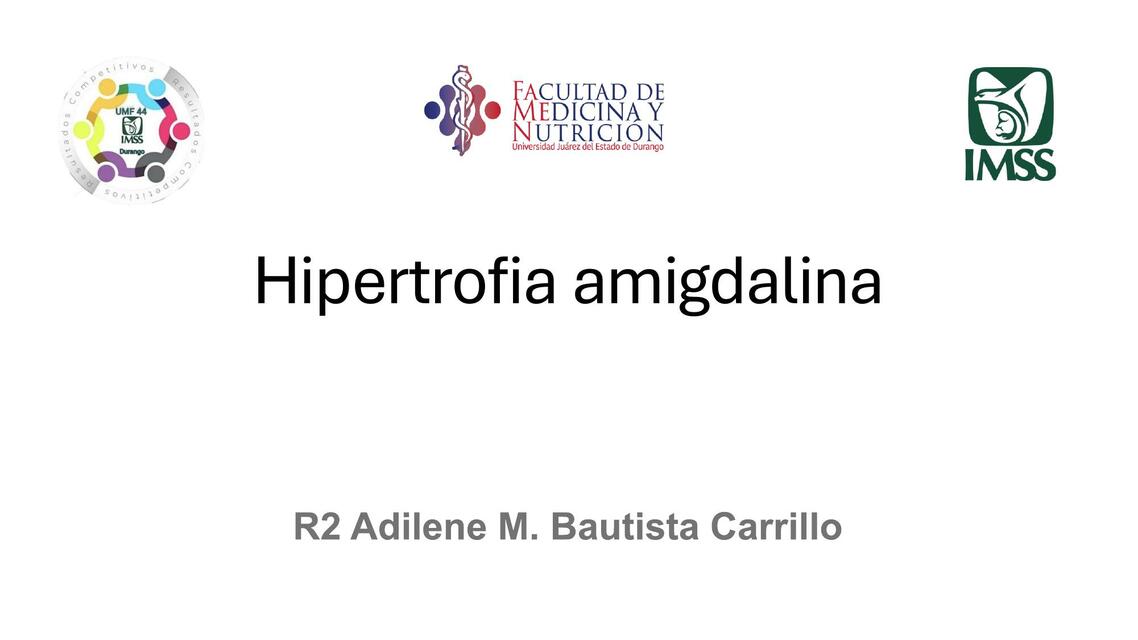 Hipertrofia amigdalina y frenillo lingual