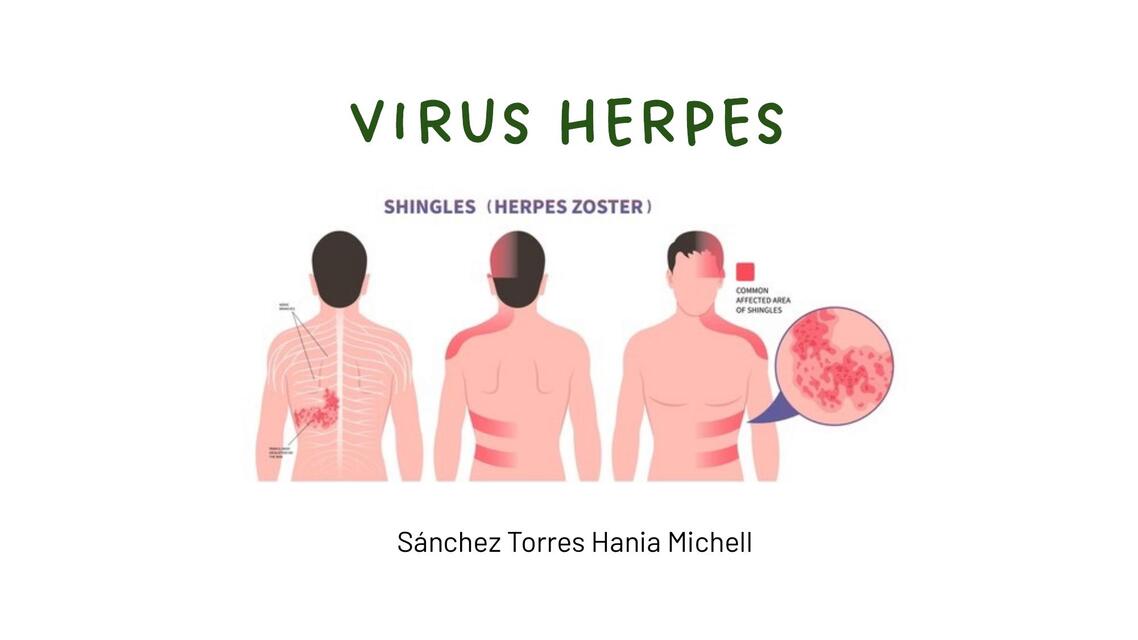 Virus herpes 