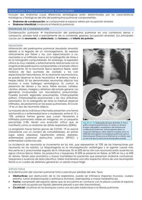 Síndromes parenquimatosos pulmonares