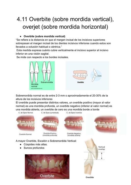 Overbite 