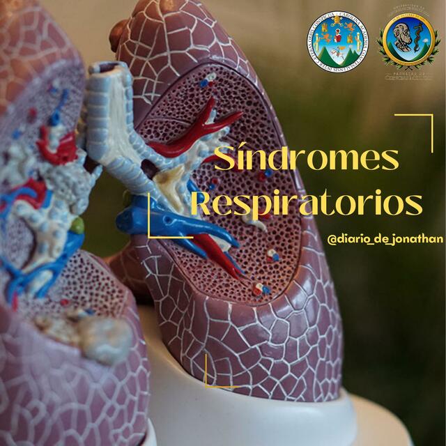 Síndromes Respiratorios 