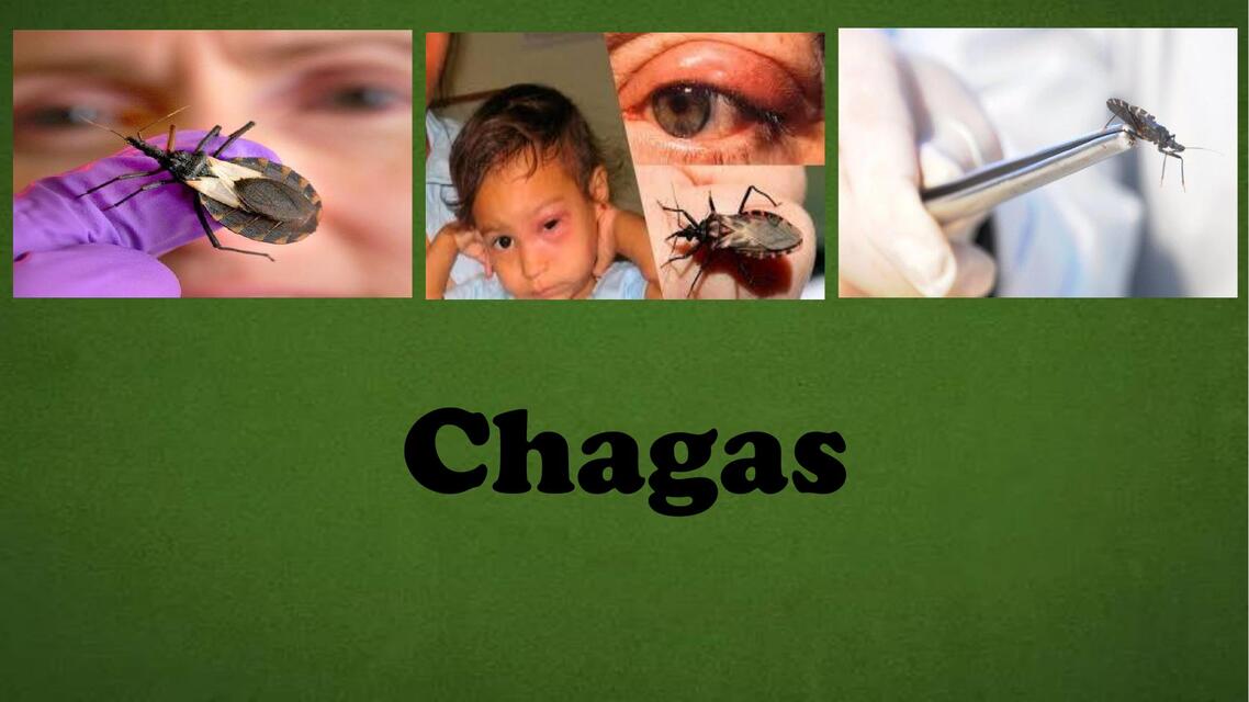 Chagas