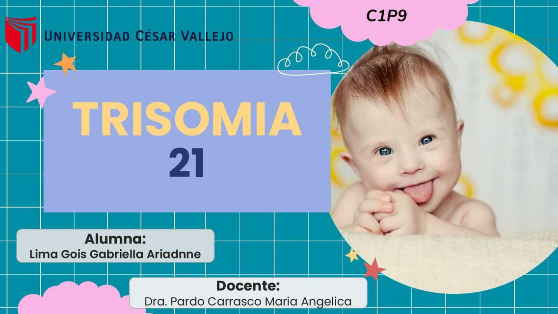 Trisomía 21