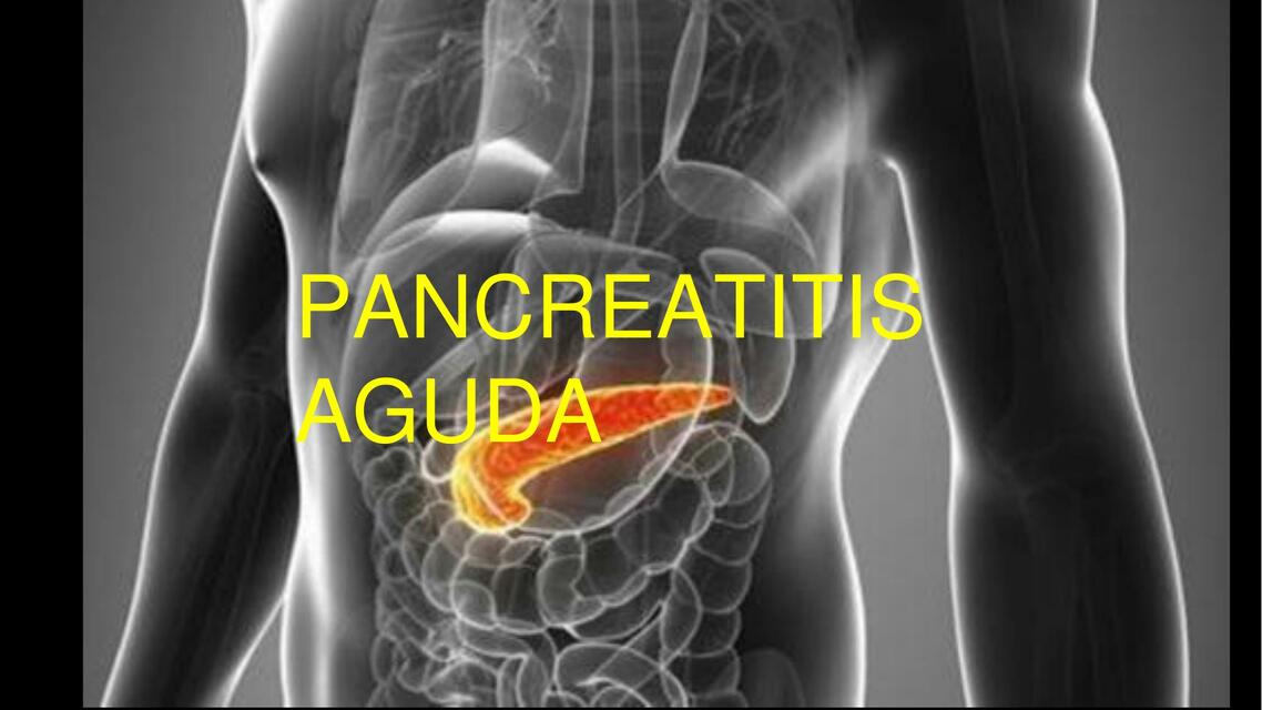 PANCREATITIS AGUDA