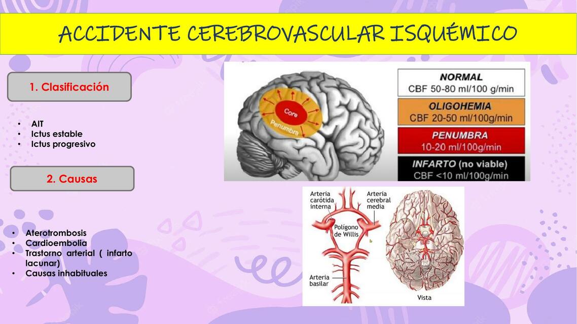 Accidente cerebrovascular isquémico 