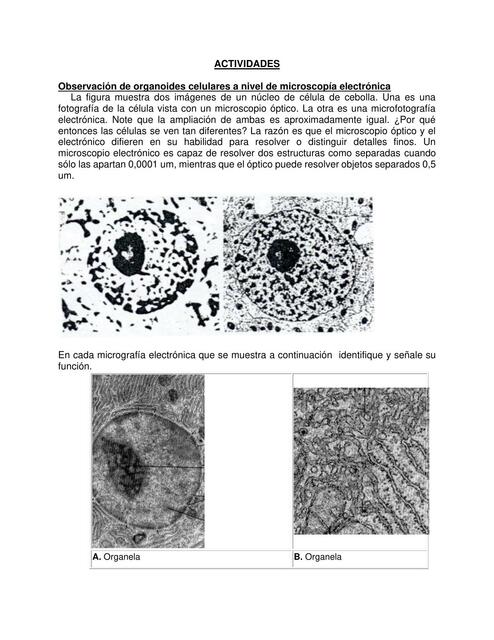 Organoides celulares a microscopía electrónica