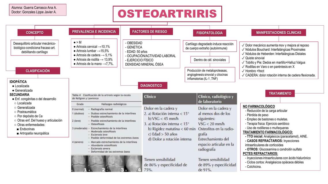 Osteoartritis 