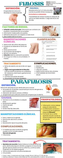 Infografía Fimosis y parafimosis