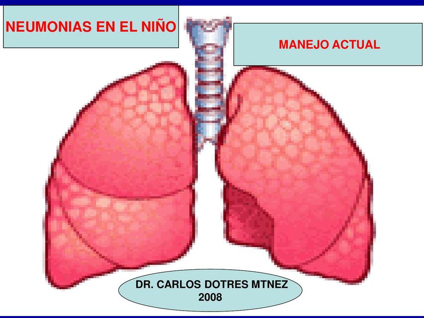 Neumonías en el niño 