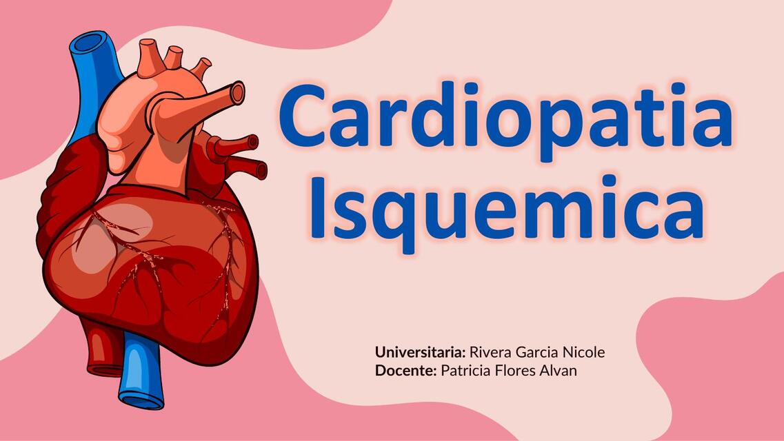 Cardiopatía Isquémica  