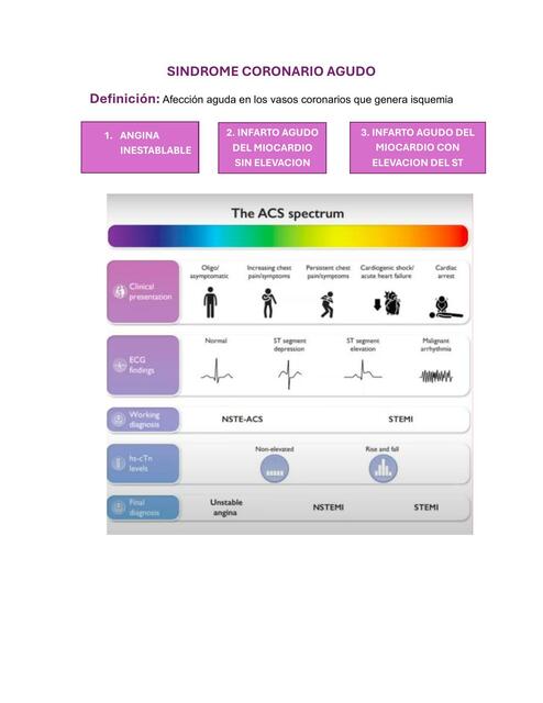 Síndrome Coronario Agudo 