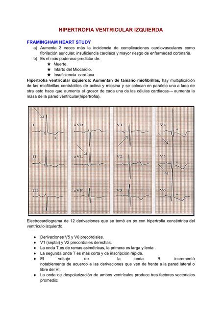 Hipertrofia ventricular izquierda 