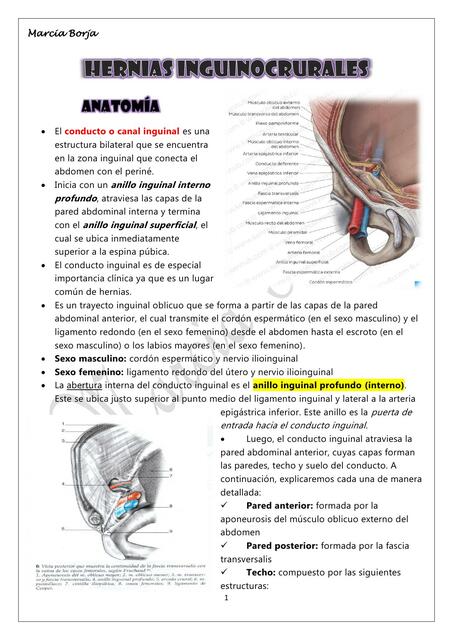 Hernias inguinocrurales