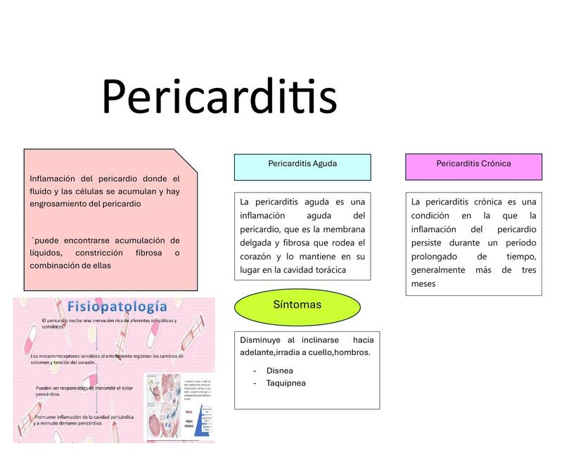 Pericarditis