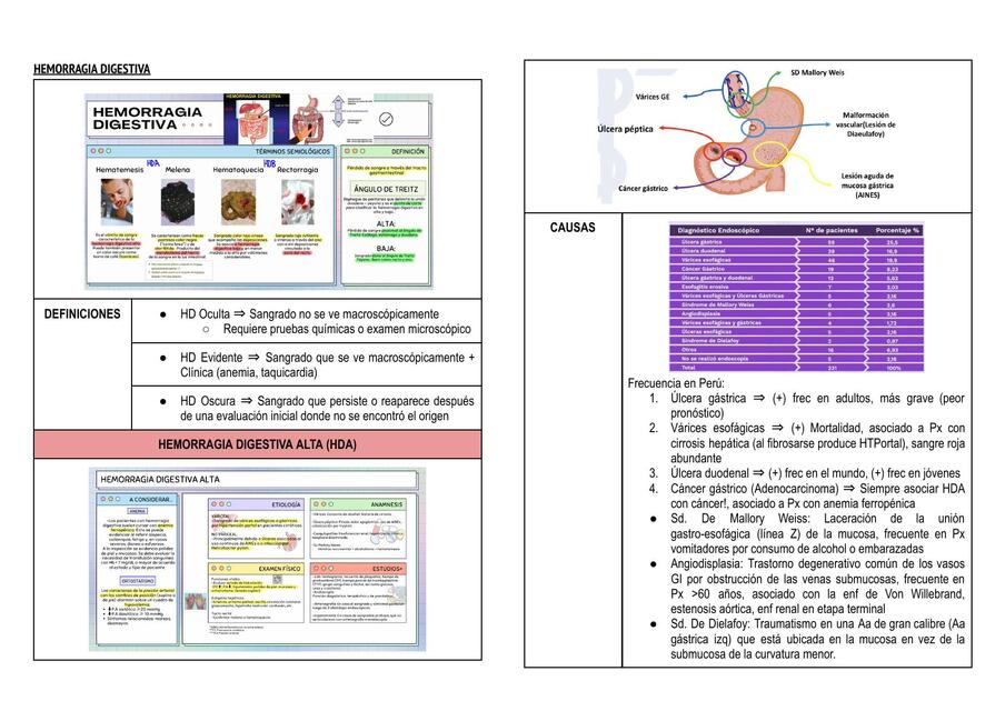 Hemorragia digestiva 