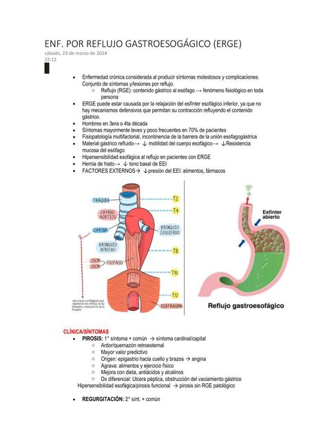 Enfermedad por reflujo gastroesofágico  