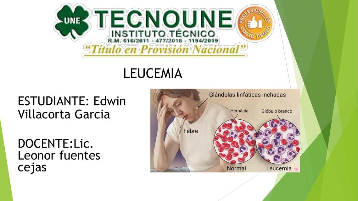 Leucemia 