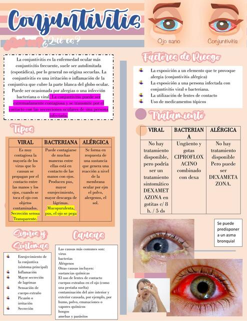 Conjuntivitis