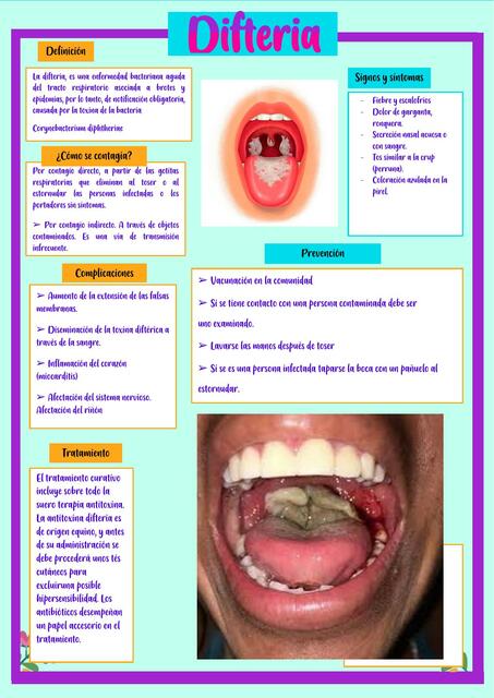 Difteria