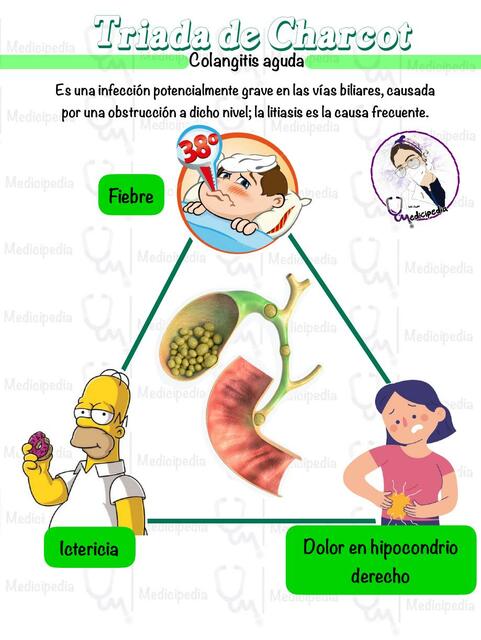 Triada de charcot | Medicipedia | uDocz