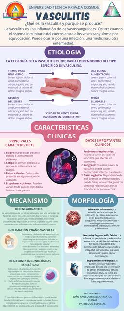 Vasculitis 