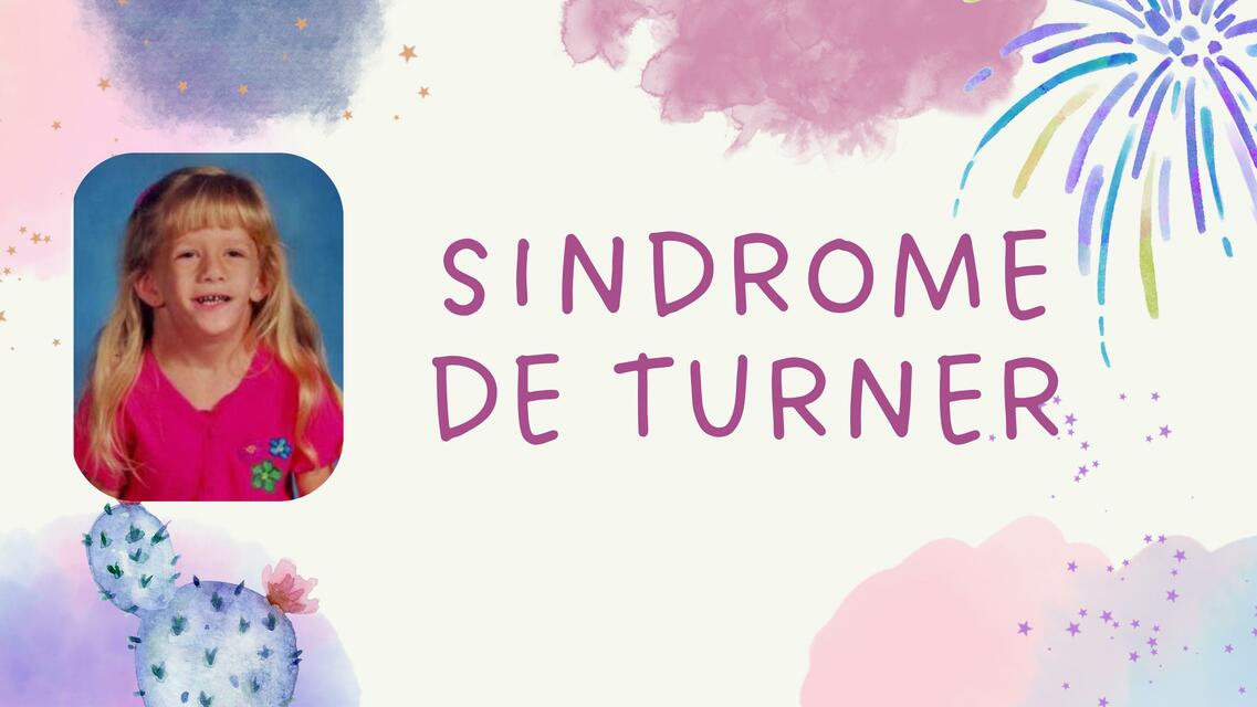 Sindrome de turner 